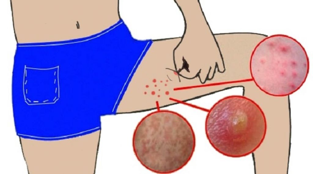 Preview Arsenal de Olho em Jeremy Jacquet: Um Jovem Defesa Central com Potencial Superior a Hincapié